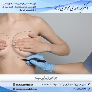 جراحی زیبایی سینه
