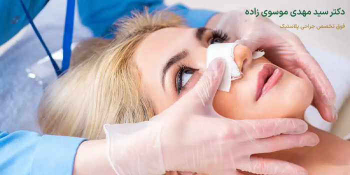 اقدامات قبل از جراحی بینی