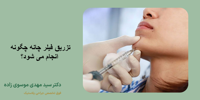 مراقبت های بعد از تزریق فیلر چانه
