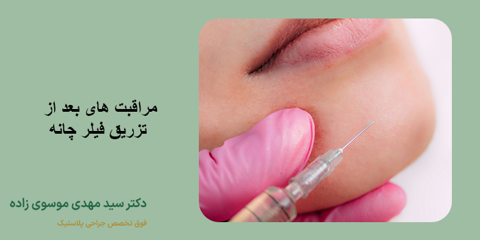 تزریق فیلر چانه 