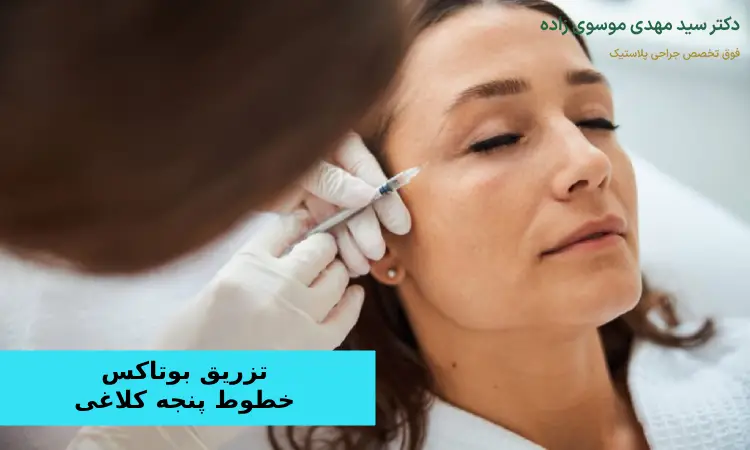 علت ایجاد خطوط پنجه کلاغی اطراف چشم