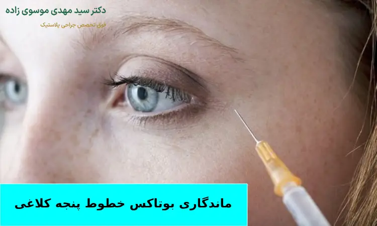 هزینه تزریق بوتاکس خطوط پنجه کلاغی