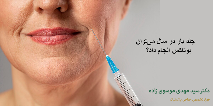 بهترین فاصله زمانی بین تزریق‌های بوتاکس چقدر است؟