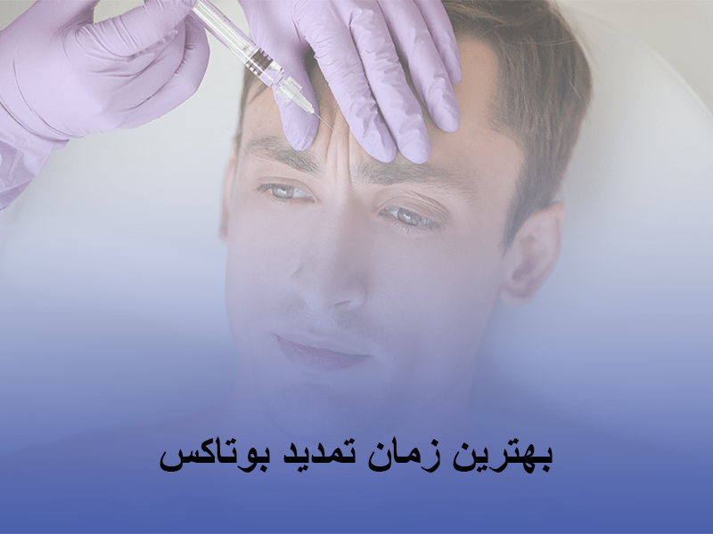 زمان تمدید بوتاکس