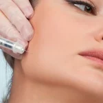زاویه‌ سازی فک با تزریق بوتاکس