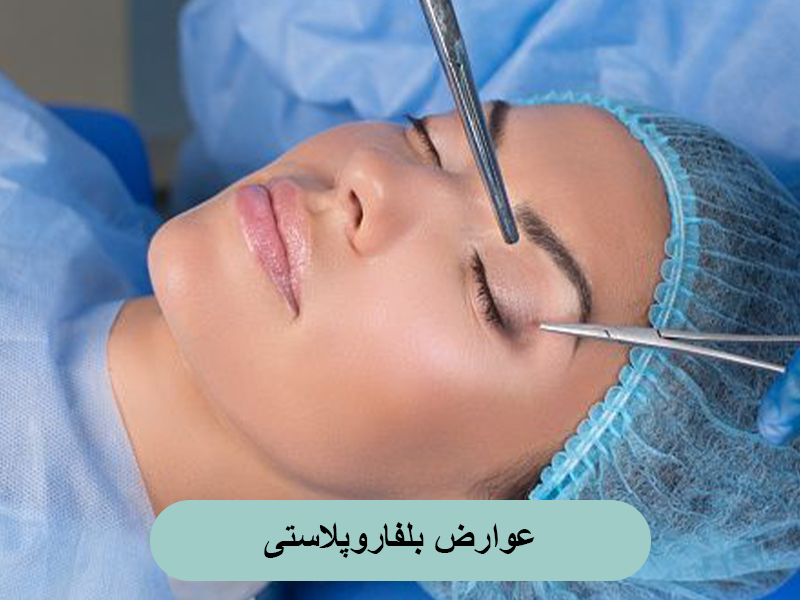 عوارض بلفاروپلاستی