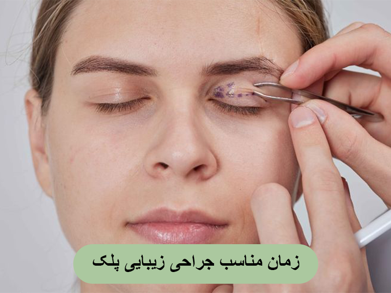 زمان مناسب جراحی زیبایی پلک