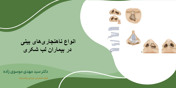 مراقبت های بعد از جراحی بینی بیماران لب شکری