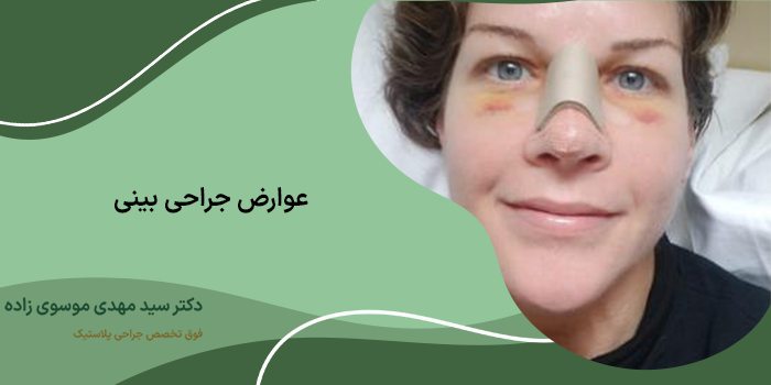 روش‌های جلوگیری از عوارض عمل بینی