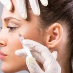 آرایش بعد بوتاکس