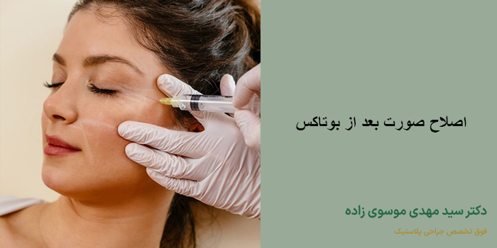 اصلاح صورت بعد از بوتاکس
