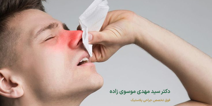 پماد بعد از عمل بینی