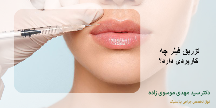 تزریق فیلر