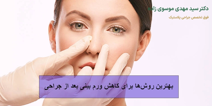 بهترین روش‌ها برای کاهش ورم بینی بعد از جراحی