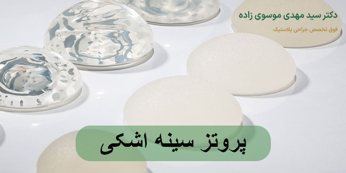 پروتز سینه اشکی