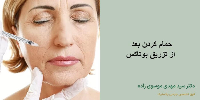 حمام کردن بعد از تزریق بوتاکس