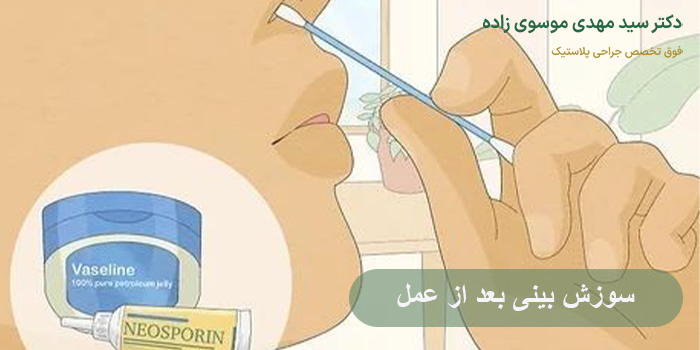 سوزش بینی بعد از عمل