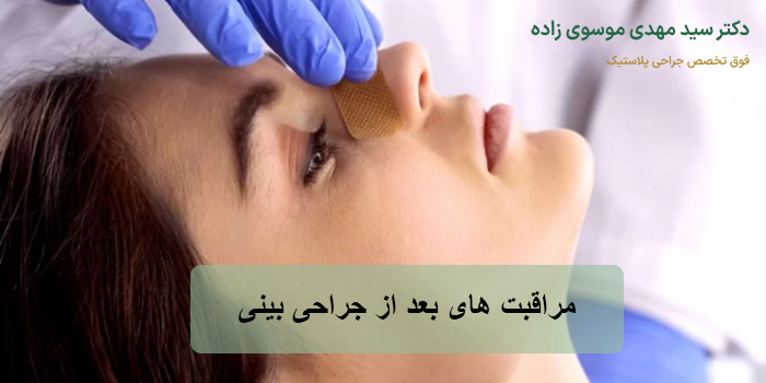 مراقبت های بعد از جراحی بینی