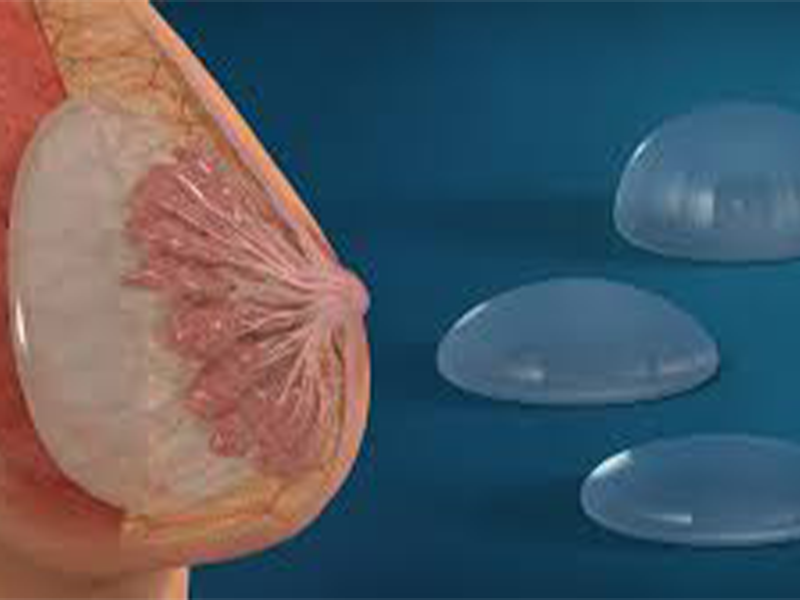 درد بعد از پروتز سینه